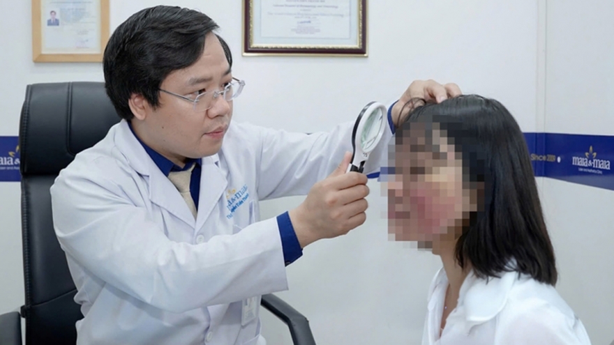 Mặt sưng phù vì tin kem trị mụn "từ thiên nhiên" trên TikTok